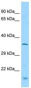 Host: Rabbit; Target Name: Mctp1; Sample Tissue: Mouse Lung lysates; Antibody Dilution: 1.0 ug/ml