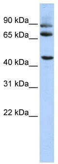 WB Suggested Anti-DPP10 Antibody Titration: 0.2-1 ug/ml; ELISA Titer: 1: 62500; Positive Control: HepG2 cell lysate