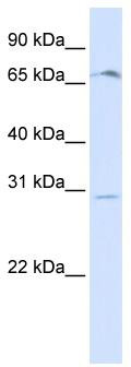 WB Suggested Anti-OR6C75 Antibody Titration: 0.2-1 ug/ml; ELISA Titer: 1: 312500; Positive Control: Human Placenta