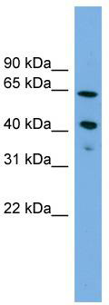 WB Suggested Anti-ATP8B2 Antibody Titration: 0.2-1 ug/ml; Positive Control: Jurkat cell lysate.ATP8B2 is supported by BioGPS gene expression data to be expressed in Jurkat