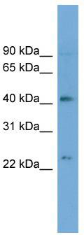 WB Suggested Anti-ATP8B2 Antibody Titration: 0.2-1 ug/ml; Positive Control: HepG2 cell lysate