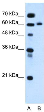 WB Suggested Anti-KIAA1754L Antibody Titration: 0.2-1 ug/ml; Positive Control: HepG2 cell lysate