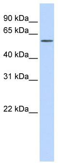 WB Suggested Anti-KIAA1754L Antibody Titration: 0.2-1 ug/ml; ELISA Titer: 1: 1562500; Positive Control: Human Liver