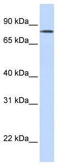 WB Suggested Anti-LST-3TM12 Antibody Titration: 0.2-1 ug/ml; ELISA Titer: 1: 1562500; Positive Control: Human Lung