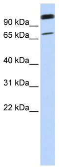 Gel: 8%SDS-PAGE<br>Lysate: 40 μg<br>Lane 1-6: K562<br>231<br>Hela<br>HepG2<br>A172<br>293T cell lysates<br>Primary antibody: TA366667 (NOP58 Antibody) at dilution 1/600<br>Secondary antibody: Goat anti rabbit IgG at 1/5000 dilution<br>Exposure time: 3 seconds