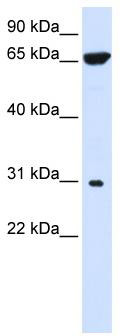 WB Suggested Anti-PTPLAD2 Antibody Titration: 0.2-1 ug/ml; ELISA Titer: 1: 1562500; Positive Control: 293T cell lysate