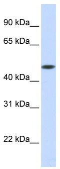 WB Suggested Anti-GLT8D1 Antibody Titration: 0.2-1 ug/ml; ELISA Titer: 1: 62500; Positive Control: Human Muscle