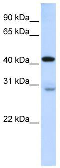 WB Suggested Anti-GRAMD2 Antibody Titration: 0.2-1 ug/ml; ELISA Titer: 1: 312500; Positive Control: Human Lung