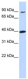 WB Suggested Anti-OR11H12 Antibody Titration: 0.2-1 ug/ml; ELISA Titer: 1: 312500; Positive Control: 721_B cell lysate