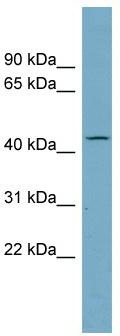 WB Suggested Anti-AADACL4 Antibody Titration: 0.2-1 ug/ml; Positive Control: Human Thymus