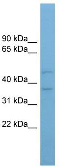 WB Suggested Anti-AADACL4 Antibody Titration: 0.2-1 ug/ml; ELISA Titer: 1: 62500; Positive Control: PANC1 cell lysate