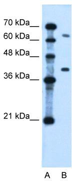 WB Suggested Anti-LRRC26 Antibody Titration: 0.2-1 ug/ml; Positive Control: Jurkat cell lysate