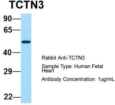 Host: Rabbit; Target Name: TCTN3; Sample Tissue: Human Fetal Heart; Antibody Dilution: 1.0 ug/ml