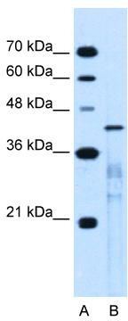 WB Suggested Anti-MARVELD3 Antibody Titration: 0.25 ug/ml; Positive Control: Jurkat cell lysate
