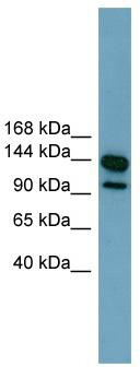WB Suggested Anti-LRRC66 Antibody Titration: 0.2-1 ug/ml; Positive Control: ACHN cell lysate