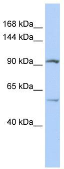 WB Suggested Anti-LRRC66 Antibody Titration: 0.2-1 ug/ml; ELISA Titer: 1: 312500; Positive Control: Jurkat cell lysate