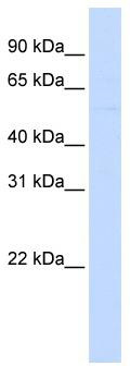 WB Suggested Anti-LRRC24 Antibody Titration: 0.2-1 ug/ml; ELISA Titer: 1: 312500; Positive Control: Hela cell lysate