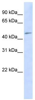 WB Suggested Anti-C3orf17 Antibody Titration: 0.2-1 ug/ml; ELISA Titer: 1: 312500; Positive Control: Hela cell lysate