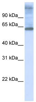 WB Suggested Anti-C3orf17 Antibody Titration: 0.2-1 ug/ml; ELISA Titer: 1: 312500; Positive Control: 721_B cell lysate