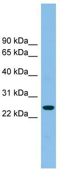 WB Suggested Anti-TSPAN4 Antibody Titration: 0.2-1 ug/ml; ELISA Titer: 1: 312500; Positive Control: Jurkat cell lysate