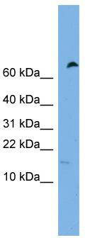 WB Suggested Anti-IFITM5 Antibody Titration: 0.2-1 ug/ml; Positive Control: Hela cell lysate