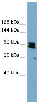 WB Suggested Anti-KIAA0317 Antibody Titration: 0.2-1 ug/ml; Positive Control: HT1080 cell lysate;AREL1 is supported by BioGPS gene expression data to be expressed in HT1080