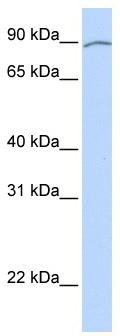 WB Suggested Anti-KIAA0317 Antibody Titration: 0.2-1 ug/ml; ELISA Titer: 1: 62500; Positive Control: Human heart