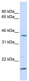 WB Suggested Anti-ZDHHC19 Antibody Titration: 0.2-1 ug/ml; ELISA Titer: 1: 312500; Positive Control: MCF7 cell lysate