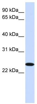 WB Suggested Anti-ZDHHC19 Antibody Titration: 0.2-1 ug/ml; ELISA Titer: 1: 62500; Positive Control: Hela cell lysate