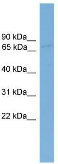 WB Suggested Anti-SDK1 Antibody Titration: 0.2-1 ug/ml; Positive Control: OVCAR-3 cell lysate