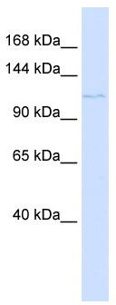 WB Suggested Anti-PTCH2 Antibody Titration: 0.2-1 ug/ml; ELISA Titer: 1: 312500; Positive Control: Human Placenta