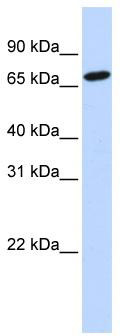 WB Suggested Anti-HAL Antibody Titration: 1 ug/ml; Positive Control: 721_B cell lysate