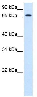 WB Suggested Anti-HAL Antibody Titration: 1.25 ug/ml; Positive Control: Fetal liver cell lysate