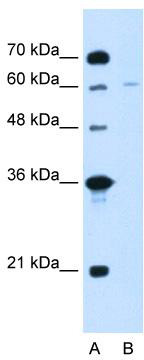 Gel: 8%SDS-PAGE<br>Lysate: 40 μg<br>Lane 1-7: Human liver tissue<br>293T cells<br>MCF7 cells<br>PC3 cells<br>HepG2 cells<br>human fetal liver tissue<br>hela cells<br>Primary antibody: TA369091 (ECHS1 Antibody) at dilution 1/200<br>Secondary antibody: Goat anti rabbit IgG at 1/8000 dilution<br>Exposure time: 20 seconds