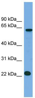 WB Suggested Anti-C21orf45 Antibody Titration: 0.2-1 ug/ml; ELISA Titer: 1: 312500; Positive Control: NCI-H226 cell lysate