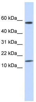 WB Suggested Anti-KRTAP11-1 Antibody Titration: 0.2-1 ug/ml; ELISA Titer: 1: 62500; Positive Control: Human Placenta