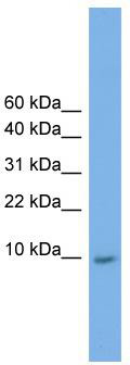 WB Suggested Anti-KRTAP23-1 Antibody Titration: 0.2-1 ug/ml; Positive Control: HepG2 cell lysate