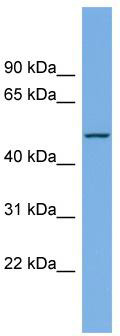 WB Suggested Anti-LIPI Antibody Titration: 0.2-1 ug/ml; Positive Control: NCI-H226 cell lysate