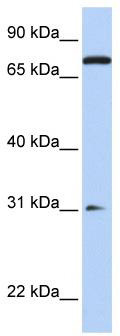 WB Suggested Anti-MAP4K1 Antibody Titration: 0.2-1 ug/ml; Positive Control: 721_B cell lysate.MAP4K1 is strongly supported by BioGPS gene expression data to be expressed in Human 721_B cells
