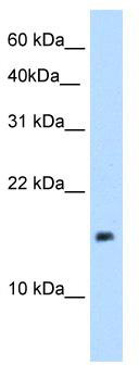 WB Suggested Anti-PAGE1 Antibody Titration: 5.0 ug/ml; Positive Control: 721_B cell lysate.PAGE1 is supported by BioGPS gene expression data to be expressed in 721_B