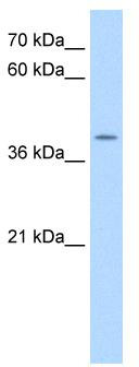WB Suggested Anti-APOBEC3B Antibody Titration: 0.2-1 ug/ml; Positive Control: HepG2 cell lysate