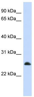 Host: Rabbit; Target Name: MRPL10; Sample Tissue: HepG2 Whole cell lysates; Antibody Dilution: 1.0 ug/ml