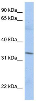 WB Suggested Anti-MRPL15 Antibody Titration: 0.2-1 ug/ml; ELISA Titer: 1: 312500; Positive Control: PANC1 cell lysate.MRPL15 is supported by BioGPS gene expression data to be expressed in PANC1