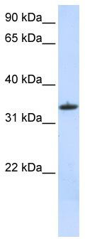 WB Suggested Anti-MRPL15 Antibody Titration: 0.2-1 ug/ml; ELISA Titer: 1: 62500; Positive Control: MCF7 cell lysate.MRPL15 is supported by BioGPS gene expression data to be expressed in MCF7