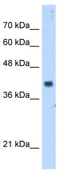 WB Suggested Anti-PDSS1 Antibody Titration: 5.0 ug/ml; Positive Control: HepG2 cell lysate.PDSS1 is supported by BioGPS gene expression data to be expressed in HepG2