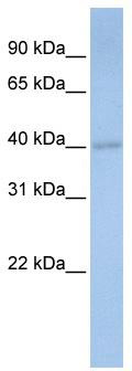 WB Suggested Anti-PDSS1 Antibody Titration: 0.2-1 ug/ml; Positive Control: Human heart