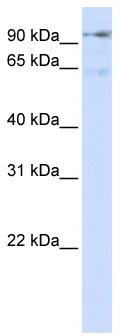 WB Suggested Anti-DLG7 Antibody Titration: 0.2-1 ug/ml; ELISA Titer: 1: 1562500; Positive Control: Transfected 293T