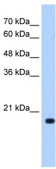 WB Suggested Anti-XTP3TPA Antibody Titration: 0.5 ug/ml; Positive Control: Transfected 293T