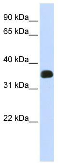 WB Suggested Anti-C2orf47 Antibody Titration: 0.2-1 ug/ml; ELISA Titer: 1: 62500; Positive Control: Human Liver