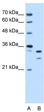 WB Suggested Anti-ANP32E Antibody Titration: 0.25 ug/ml; Positive Control: HepG2 cell lysate